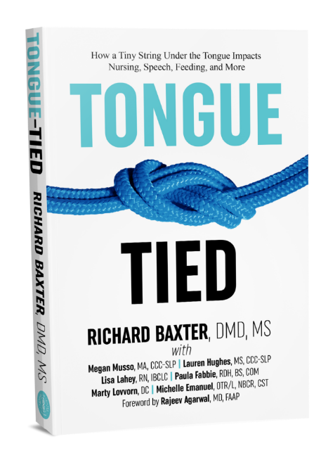 Release Tongue Ties Laser Technology Tongue Ties Birmingham AL book tongue tie