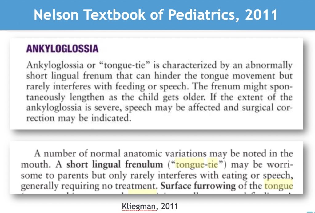 The Tongue-Tie Will Stretch Out And Other Common Myths, Part 2