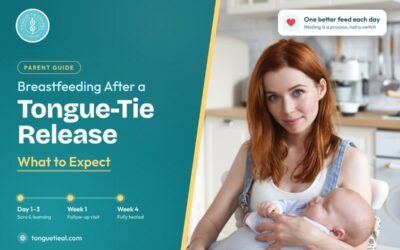Breastfeeding After a Tongue-Tie Release: What to Expect