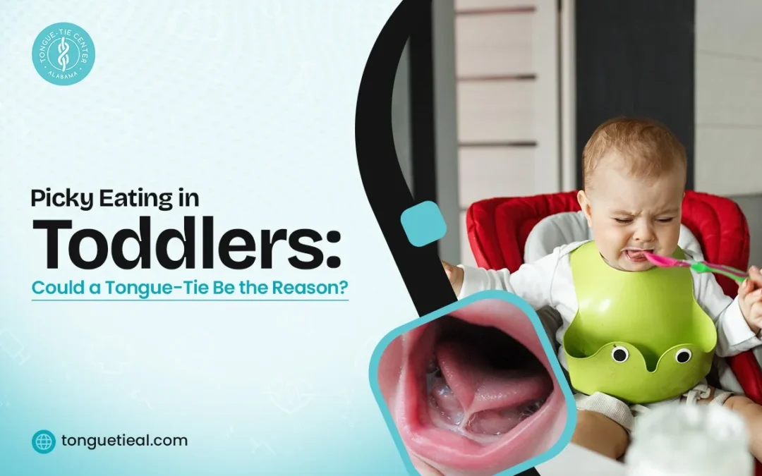 Picky Eating in Toddlers: Could a Tongue-Tie Be the Reason?