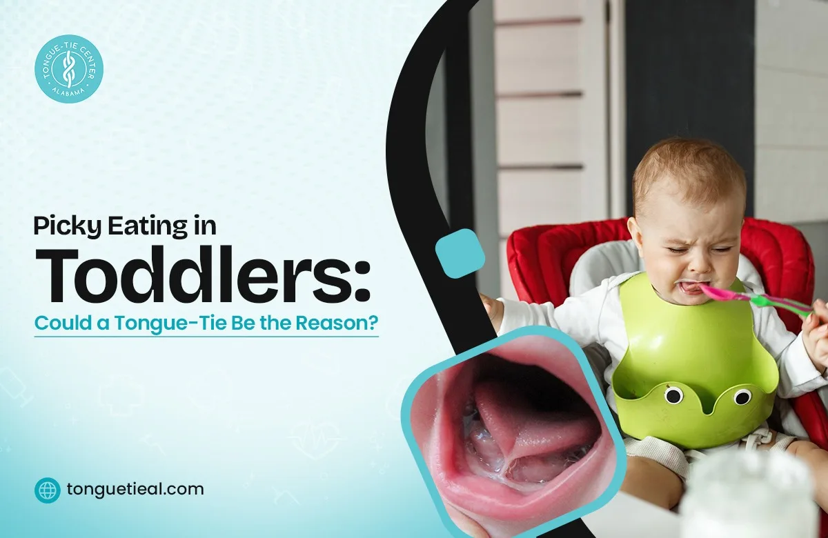 Picky Eating in Toddlers Picky Eating in Toddlers: Could It Be a Tongue-Tie?