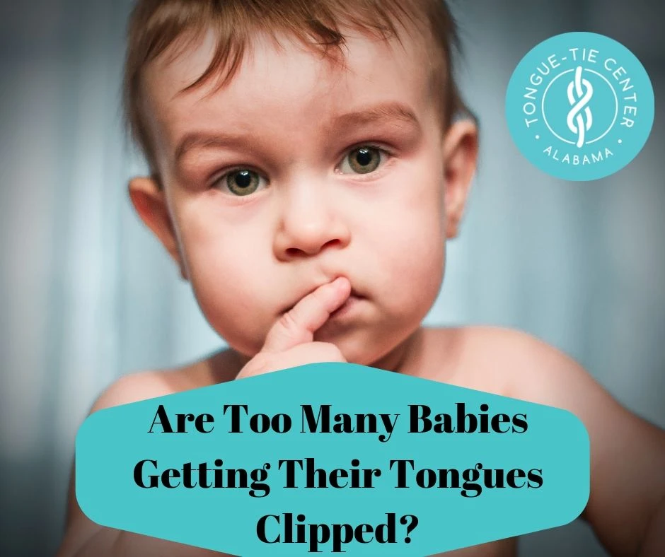 Are Too Many Babies Getting Their Tongues Clipped