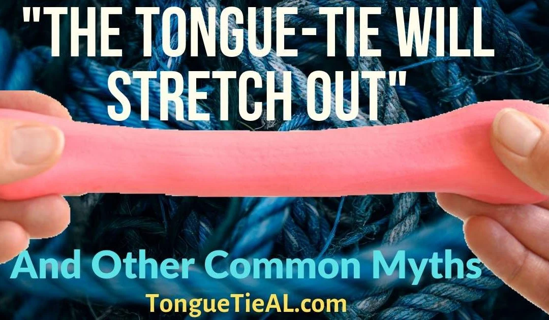 “The Tongue-Tie Will Stretch Out” And Other Common Myths, Part 2.