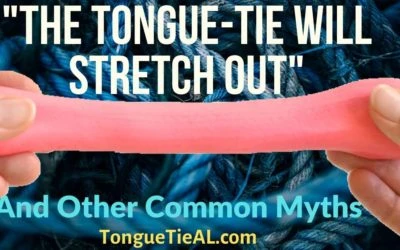 “The Tongue-Tie Will Stretch Out” And Other Common Myths, Part 2.