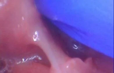 Is This a Tongue-Tie?