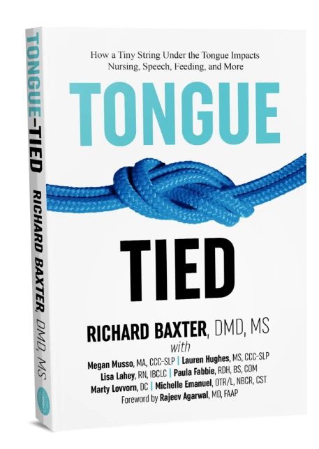 tongue-tie-education-support-tongue-tied-book Cover illustration of Dr. Baxter's Tongue Tied book