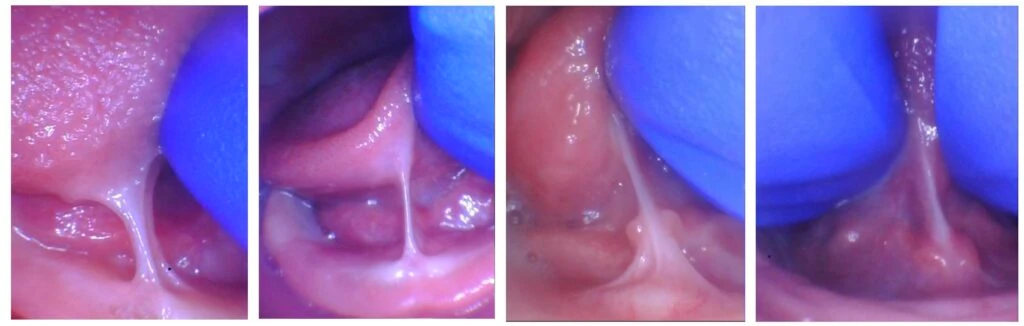 Screenshot Screenshot