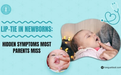 Lip-Tie in Newborns: Hidden Symptoms Most Parents Miss
