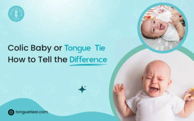 Colic Baby or Tongue-Tie? How to Tell the Difference