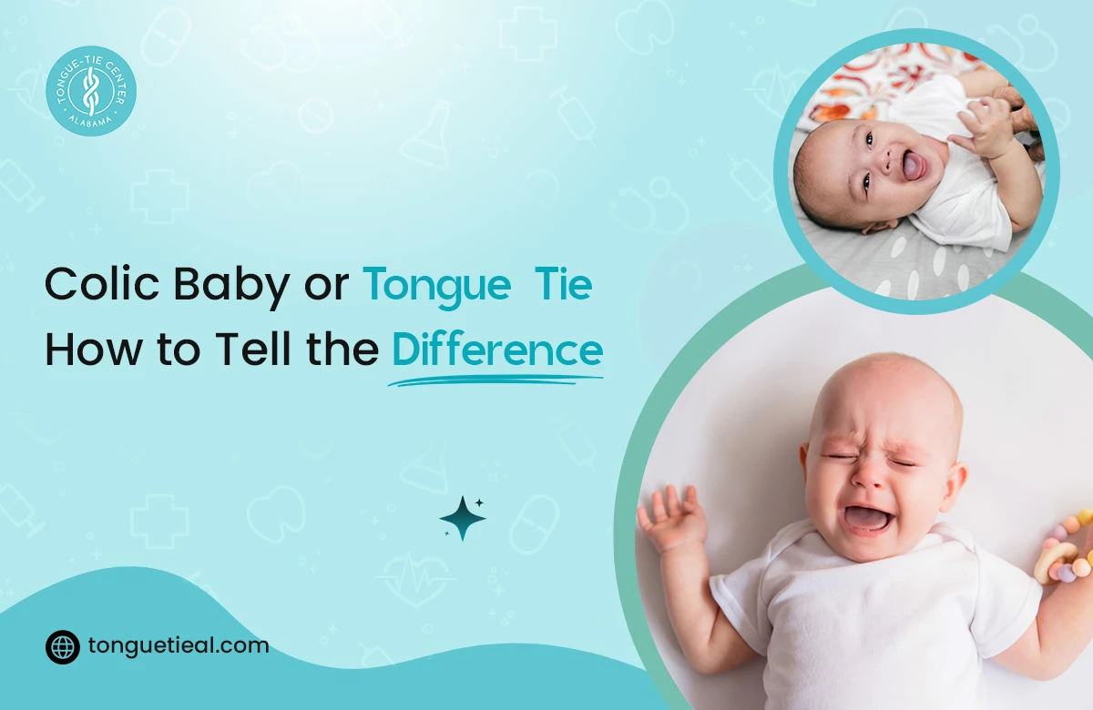 Colic Baby or Tongue Tie Signs Every Parent Should Know