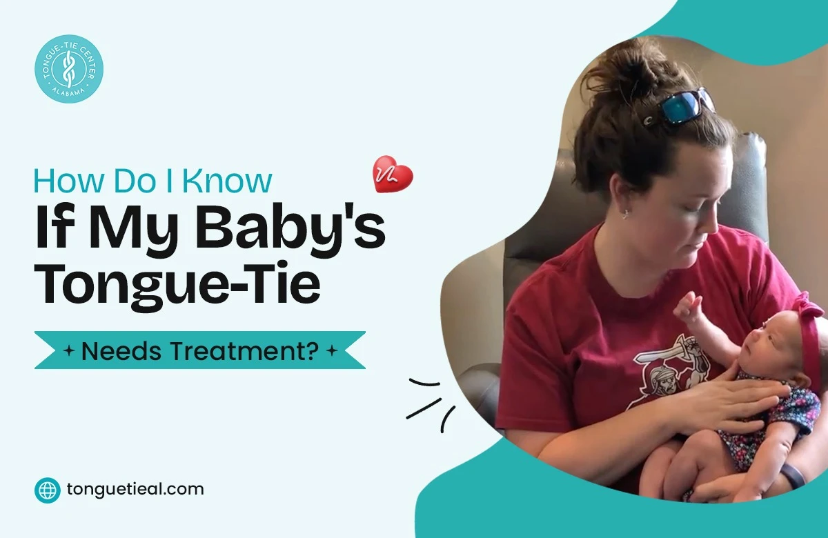 Does Tongue Tie Need Treatment When Does Tongue-Tie Need Treatment? A Guide for Parents